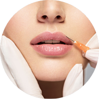 Dermal Fillers